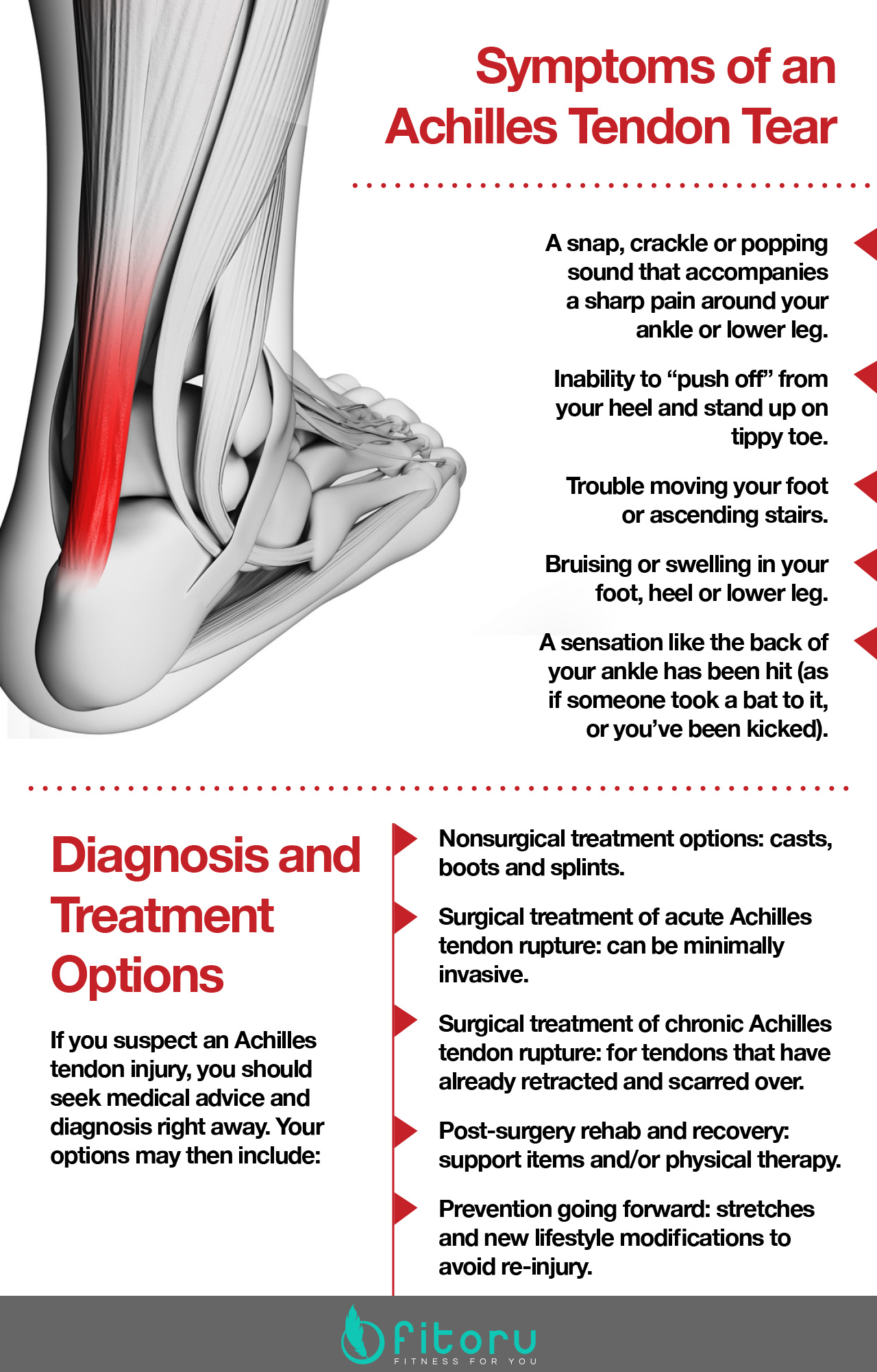 Achilles tendon tears: treatment options and advice.